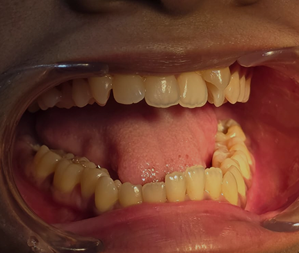 Clinical Examination at Sans Dental Studio
